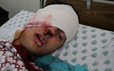 mohamad-zanoun-wounded.jpg